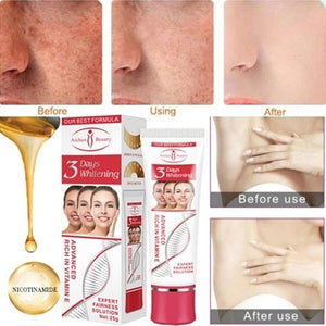 Anti Aging Cream Women 3 Days Whitening Moisturizing Cream Skin Care Anti Freckle Lightening Cream Dark Spot Remover Face Care